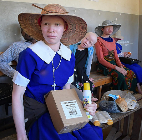 Activist wants learners with albinism wear hats and long-sleeve shirts in class