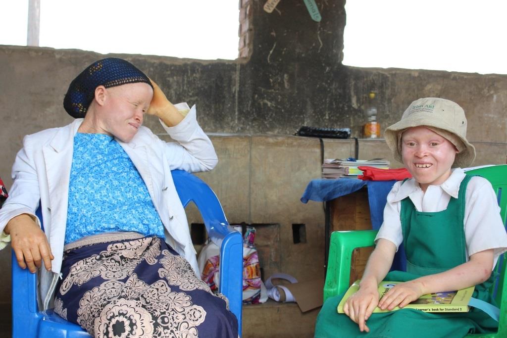 New Policy in Malawi offers persons with albinism hope